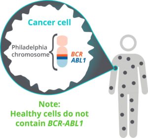 cml patients-philadelphia chromosome-cancer cell